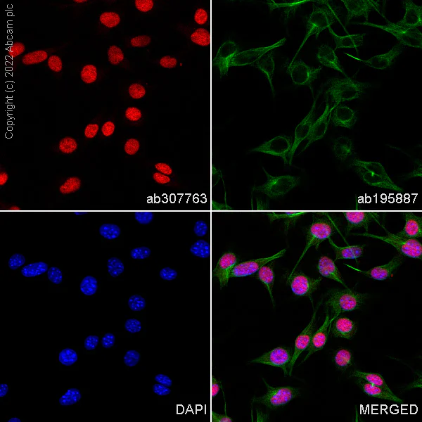 Immunocytochemistry/ Immunofluorescence - Alexa Fluor® 555 Anti-SOX10 antibody [SP267] (AB307763)