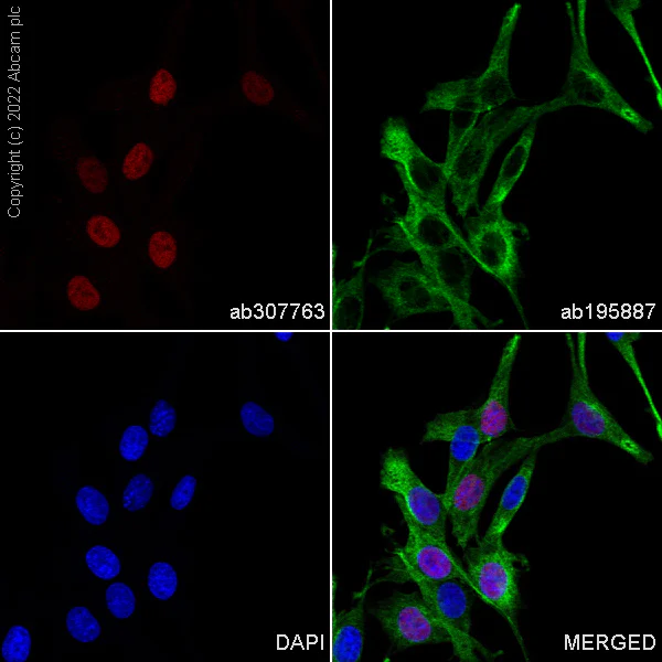 Immunocytochemistry/ Immunofluorescence - Alexa Fluor® 555 Anti-SOX10 antibody [SP267] (AB307763)