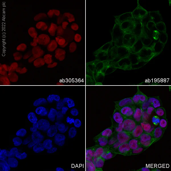 Immunocytochemistry/ Immunofluorescence - Alexa Fluor® 555 Anti-SOX2 antibody [EPR3131] (AB305364)