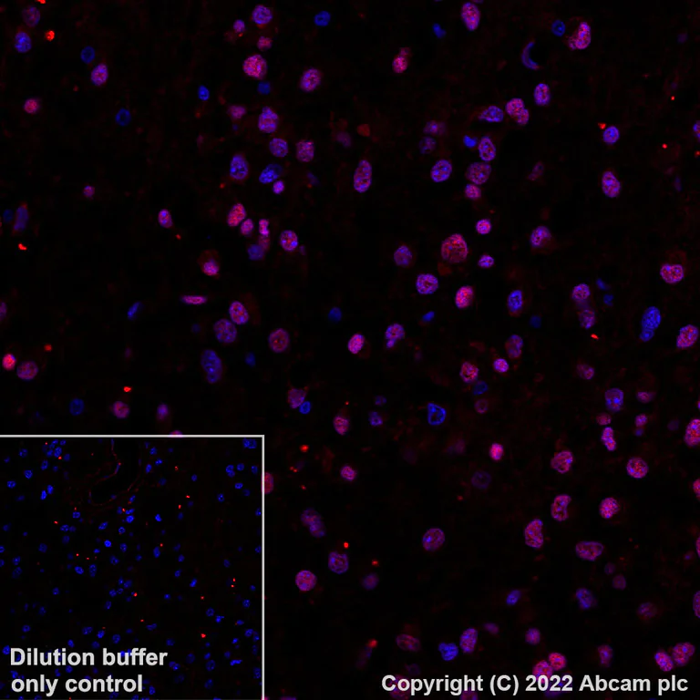 Immunohistochemistry (Formalin/PFA-fixed paraffin-embedded sections) - Alexa Fluor® 555 Anti-SOX2 antibody [EPR3131] (AB305364)