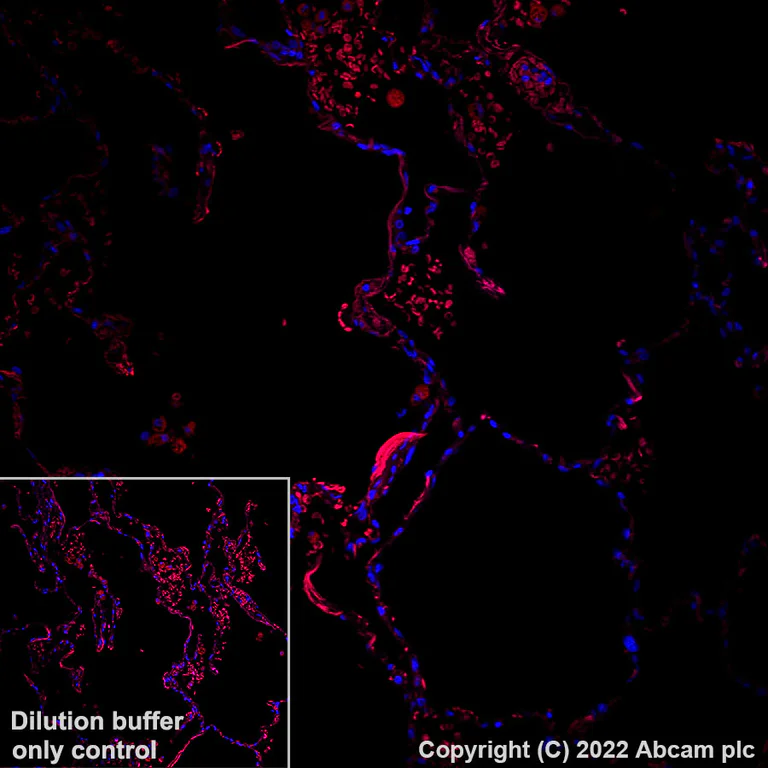 Immunohistochemistry (Formalin/PFA-fixed paraffin-embedded sections) - Alexa Fluor® 555 Anti-SOX2 antibody [EPR3131] (AB305364)