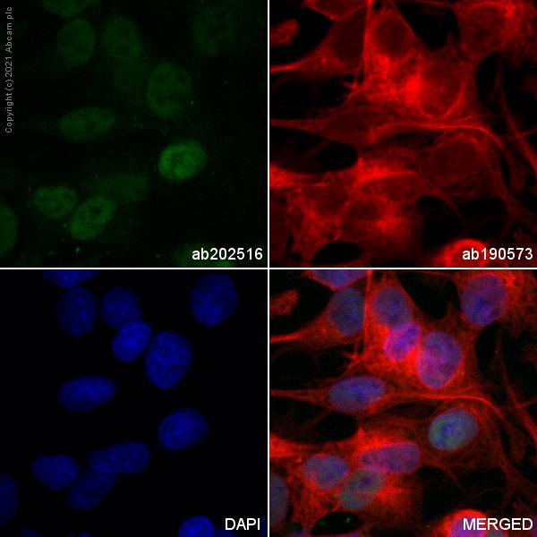 Immunocytochemistry/ Immunofluorescence - Alexa Fluor® 555 Anti-SOX9 antibody [EPR14335] (AB202516), expandable thumbnail