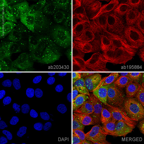 Immunocytochemistry/ Immunofluorescence - Alexa Fluor® 555 Anti-SQSTM1 / p62 antibody [EPR4844] - Autophagosome Marker (AB203430)