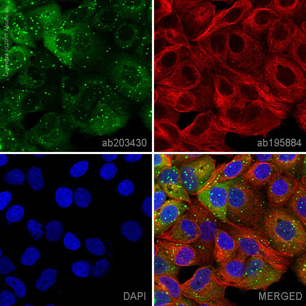 Immunocytochemistry/ Immunofluorescence - Alexa Fluor® 555 Anti-SQSTM1 / p62 antibody [EPR4844] - Autophagosome Marker (AB203430)