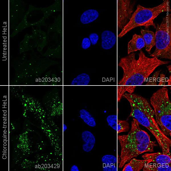 Immunocytochemistry/ Immunofluorescence - Alexa Fluor® 555 Anti-SQSTM1 / p62 antibody [EPR4844] - Autophagosome Marker (AB203430)
