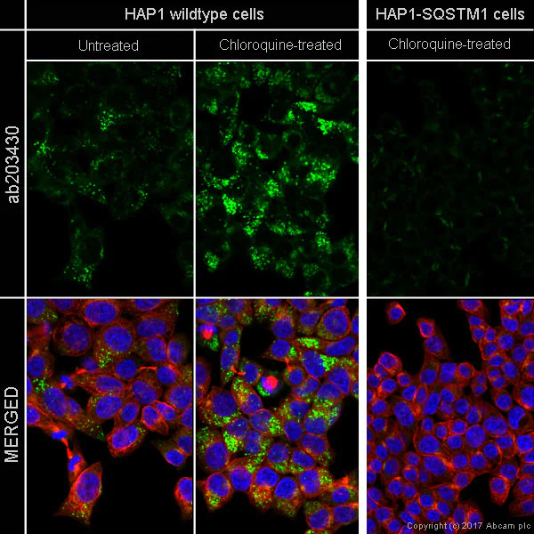 Immunocytochemistry/ Immunofluorescence - Alexa Fluor® 555 Anti-SQSTM1 / p62 antibody [EPR4844] - Autophagosome Marker (AB203430)