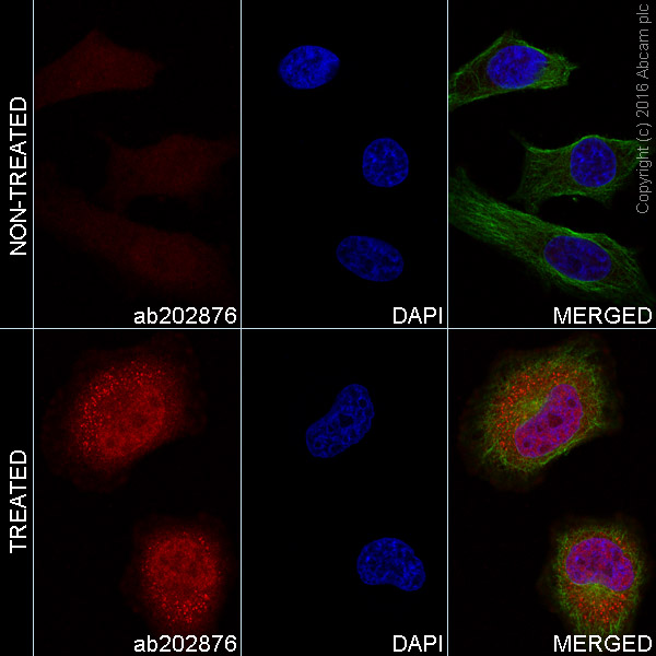 Immunocytochemistry/ Immunofluorescence - Alexa Fluor® 555 Anti-STAT3 (phospho Y705) antibody [EP2147Y] (AB202876)