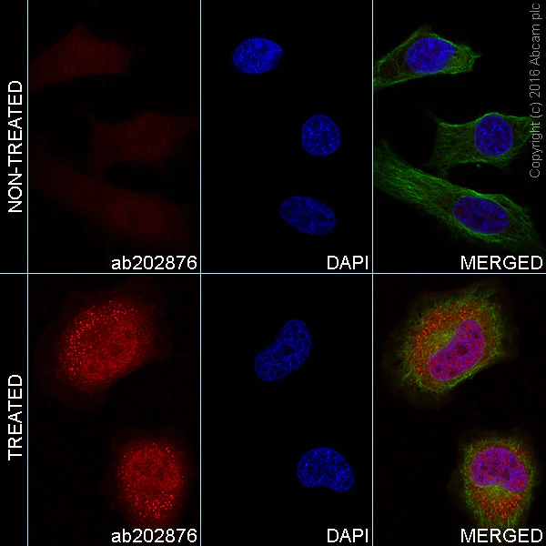 Immunocytochemistry/ Immunofluorescence - Alexa Fluor® 555 Anti-STAT3 (phospho Y705) antibody [EP2147Y] (AB202876)