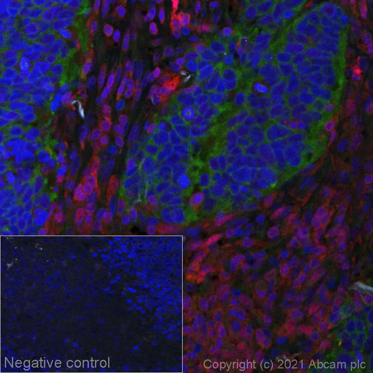 Immunohistochemistry (Formalin/PFA-fixed paraffin-embedded sections) - Alexa Fluor® 555 Anti-STAT5a antibody [E289] (AB279325)