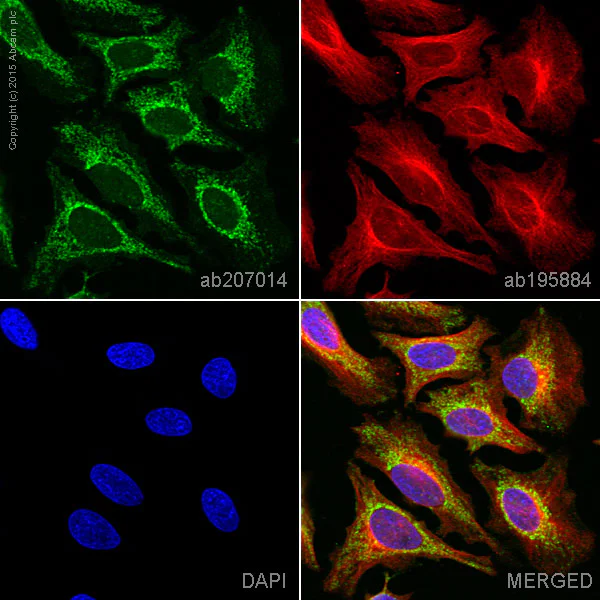 Immunocytochemistry/ Immunofluorescence - Alexa Fluor® 555 Anti-STAT6 antibody [YE361] (AB207014)