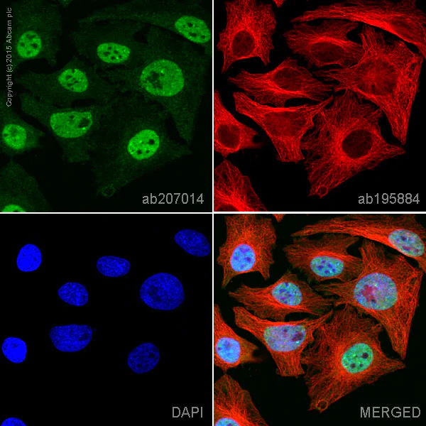 Immunocytochemistry/ Immunofluorescence - Alexa Fluor® 555 Anti-STAT6 antibody [YE361] (AB207014)