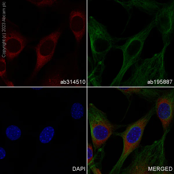 Immunocytochemistry/ Immunofluorescence - Alexa Fluor® 555 Anti-Superoxide Dismutase 1 antibody [EP1727Y] (AB314510)