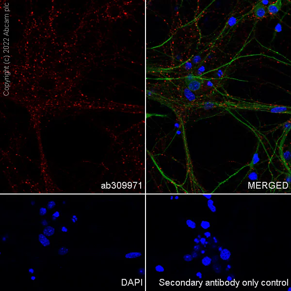 Immunocytochemistry/ Immunofluorescence - Alexa Fluor® 555 Anti-Synapsin I - Synaptic Marker antibody [EPR23531-50] (AB309971)