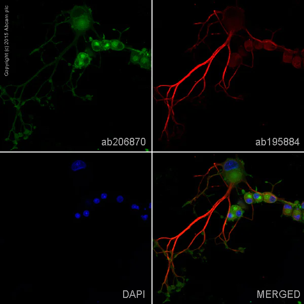 Immunocytochemistry/ Immunofluorescence - Alexa Fluor® 555 Anti-Synaptophysin antibody [YE269] - Synaptic Marker (AB206870)