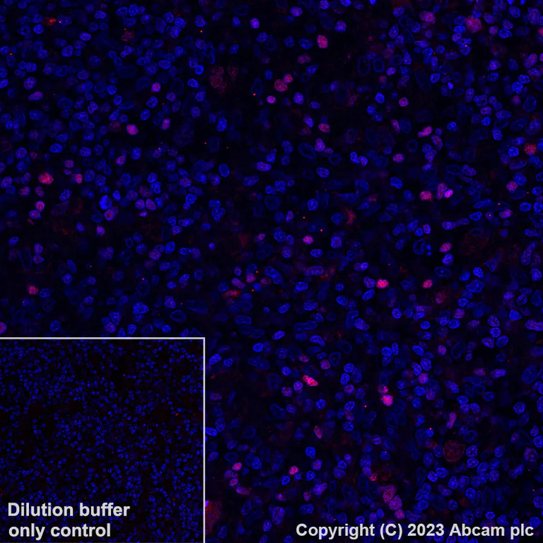 Immunohistochemistry (Formalin/PFA-fixed paraffin-embedded sections) - Alexa Fluor® 555 Anti-T-bet / Tbx21 antibody [EPR9302] (AB312912)