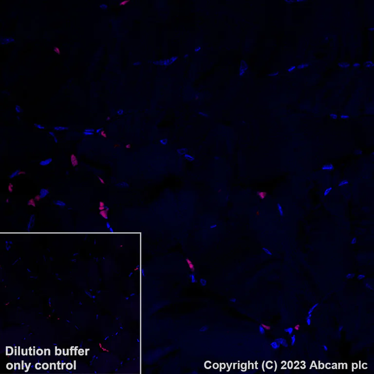 Immunohistochemistry (Formalin/PFA-fixed paraffin-embedded sections) - Alexa Fluor® 555 Anti-T-bet / Tbx21 antibody [EPR9302] (AB312912)