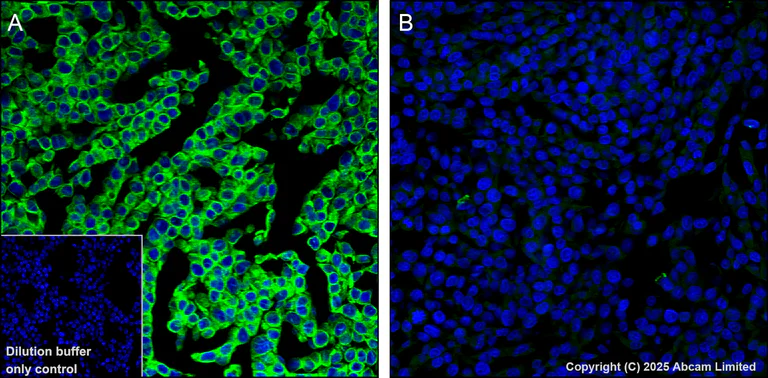 Immunohistochemistry (Formalin/PFA-fixed paraffin-embedded sections) - Alexa Fluor® 555 Anti-TAP1 antibody [EPR26236-92] (AB325702)