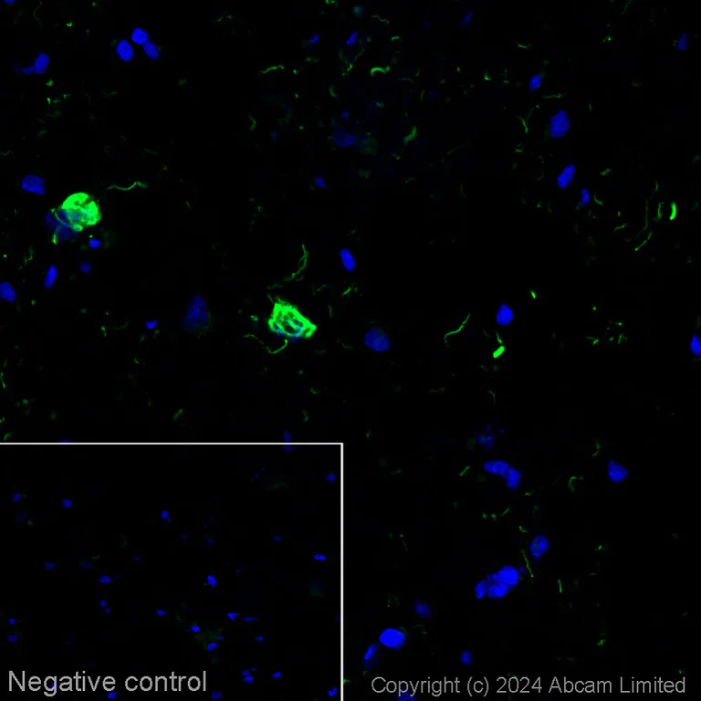 Immunohistochemistry (Frozen sections) - Alexa Fluor® 555 Anti-Tau Alzheimer’s Disease antibody [GT-38] - Conformation-Specific (AB320065)