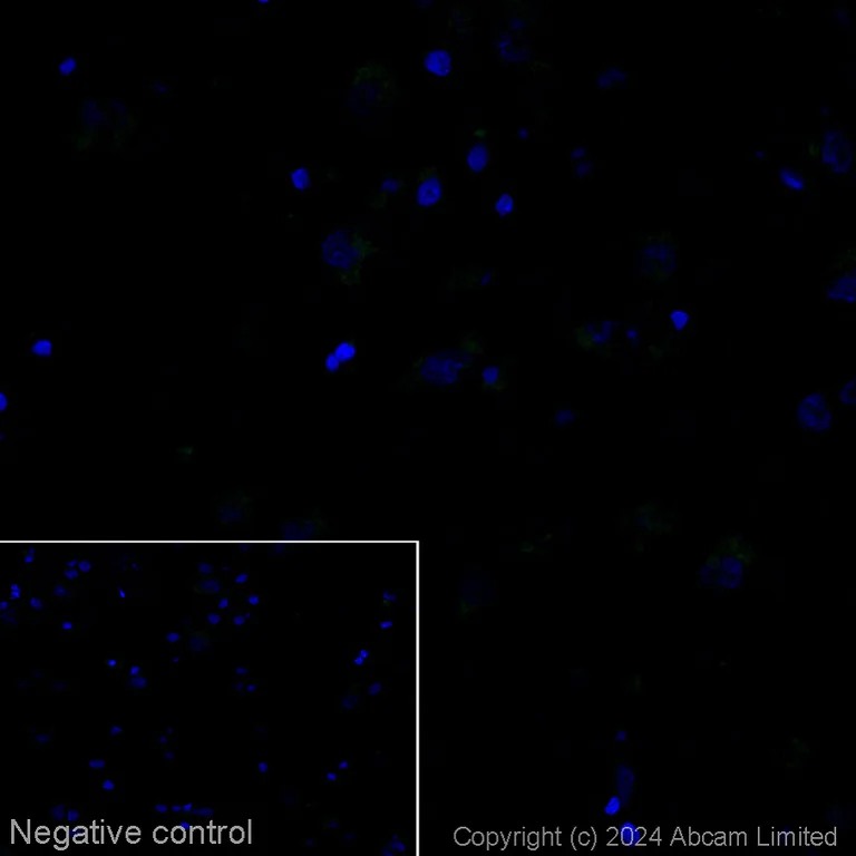 Immunohistochemistry (Frozen sections) - Alexa Fluor® 555 Anti-Tau Alzheimer’s Disease antibody [GT-38] - Conformation-Specific (AB320065)