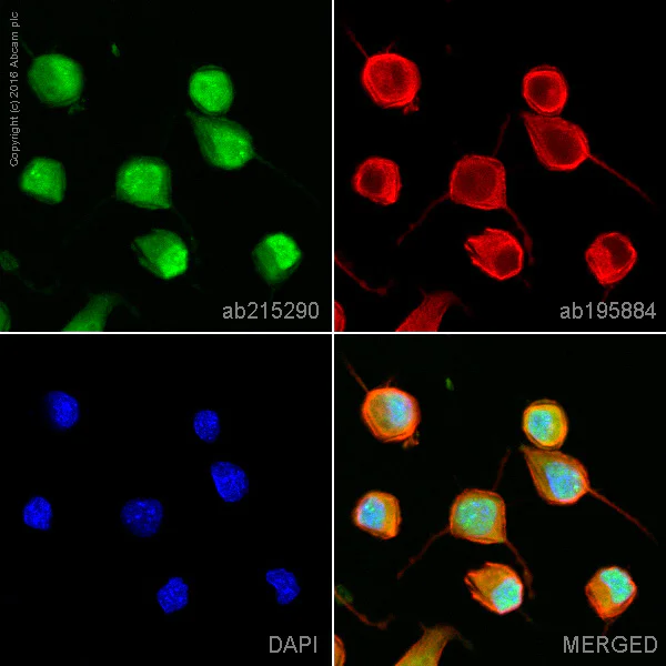 Immunocytochemistry/ Immunofluorescence - Alexa Fluor® 555 Anti-Tau antibody [EP2456Y] (AB215290)