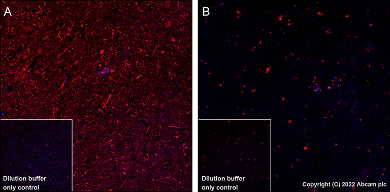Immunohistochemistry (Formalin/PFA-fixed paraffin-embedded sections) - Alexa Fluor® 555 Anti-Tau (phospho S396) antibody [E178] (AB305369)