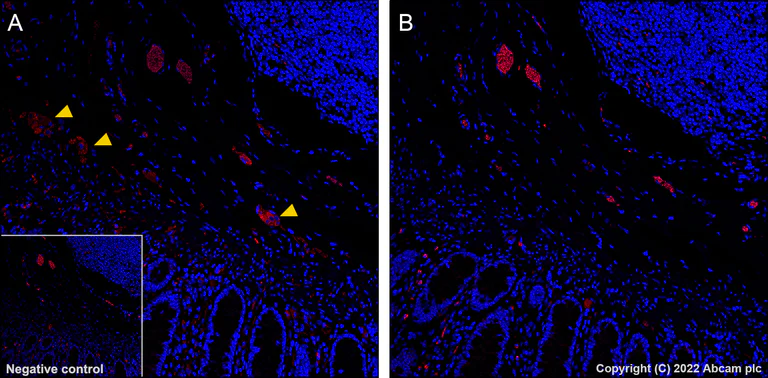 Immunohistochemistry (Formalin/PFA-fixed paraffin-embedded sections) - Alexa Fluor® 555 Anti-Tau (phospho S396) antibody [EPR2731] (AB302570)