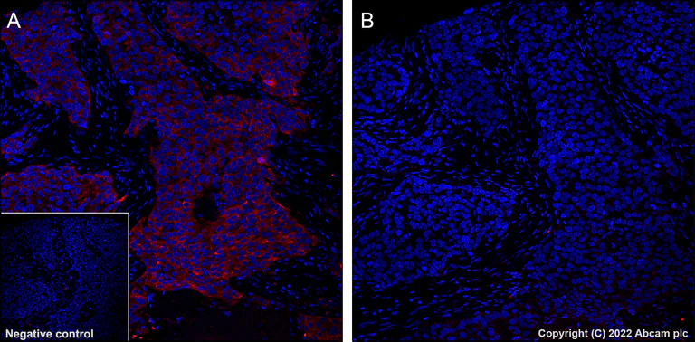 Immunohistochemistry (Formalin/PFA-fixed paraffin-embedded sections) - Alexa Fluor® 555 Anti-Tau (phospho S396) antibody [EPR2731] (AB302570)