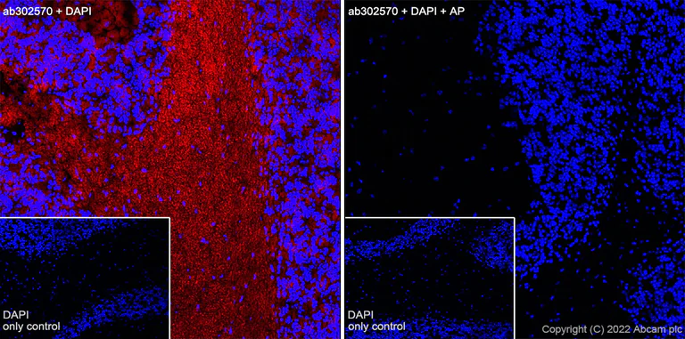 Immunohistochemistry (Frozen sections) - Alexa Fluor® 555 Anti-Tau (phospho S396) antibody [EPR2731] (AB302570)