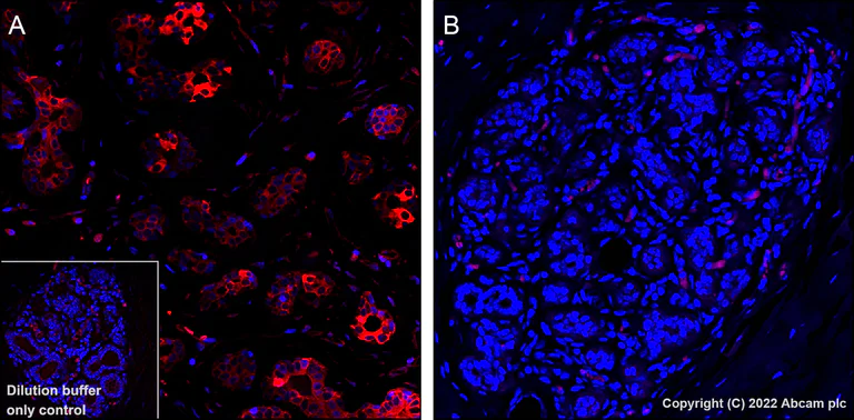 Immunohistochemistry (Formalin/PFA-fixed paraffin-embedded sections) - Alexa Fluor® 555 Anti-Tau (phospho T205) antibody [EPR23505-13] (AB307334)