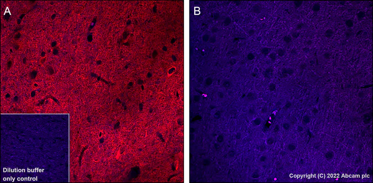 Immunohistochemistry (Formalin/PFA-fixed paraffin-embedded sections) - Alexa Fluor® 555 Anti-Tau (phospho T205) antibody [EPR23505-13] (AB307334)