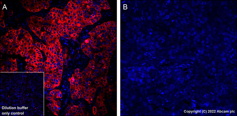 Immunohistochemistry (Formalin/PFA-fixed paraffin-embedded sections) - Alexa Fluor® 555 Anti-Tau (phospho T205) antibody [EPR23505-13] (AB307334)