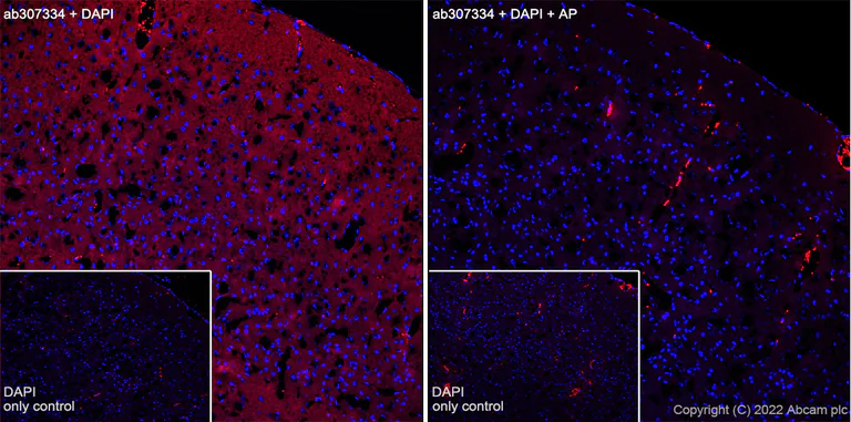 Immunohistochemistry (Frozen sections) - Alexa Fluor® 555 Anti-Tau (phospho T205) antibody [EPR23505-13] (AB307334)