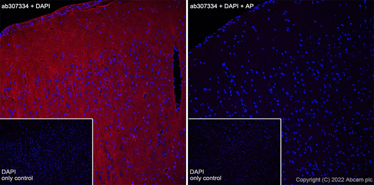 Immunohistochemistry (Frozen sections) - Alexa Fluor® 555 Anti-Tau (phospho T205) antibody [EPR23505-13] (AB307334)