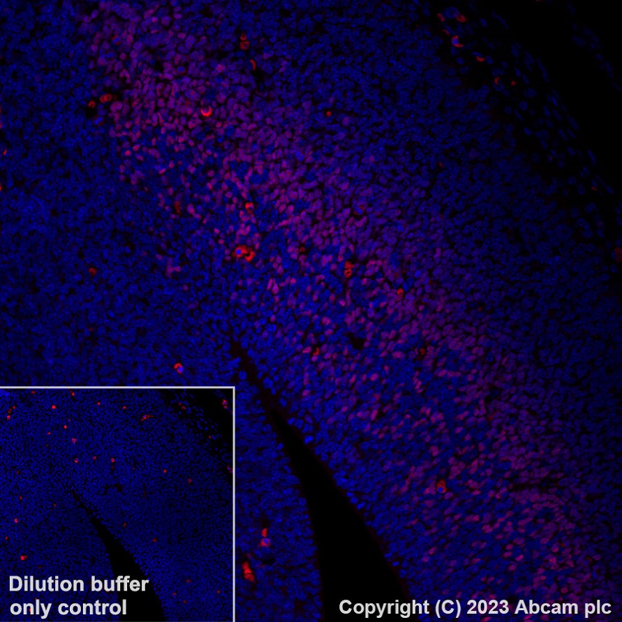 Immunohistochemistry (Formalin/PFA-fixed paraffin-embedded sections) - Alexa Fluor® 555 Anti-TBR2 / Eomes antibody [EPR19012] (AB315133), expandable thumbnail