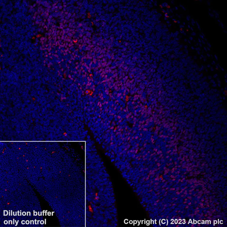 Immunohistochemistry (Formalin/PFA-fixed paraffin-embedded sections) - Alexa Fluor® 555 Anti-TBR2 / Eomes antibody [EPR19012] (AB315133)