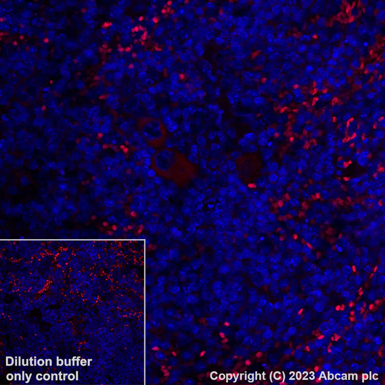 Immunohistochemistry (Formalin/PFA-fixed paraffin-embedded sections) - Alexa Fluor® 555 Anti-TGF beta 1 antibody [EPR21143] (AB313730)