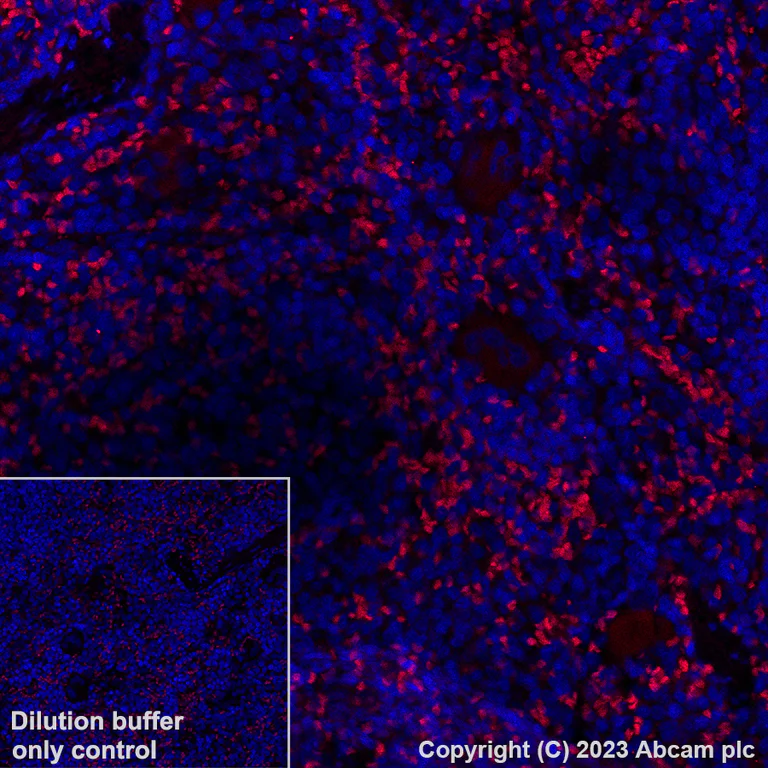 Immunohistochemistry (Formalin/PFA-fixed paraffin-embedded sections) - Alexa Fluor® 555 Anti-TGF beta 1 antibody [EPR21143] (AB313730)
