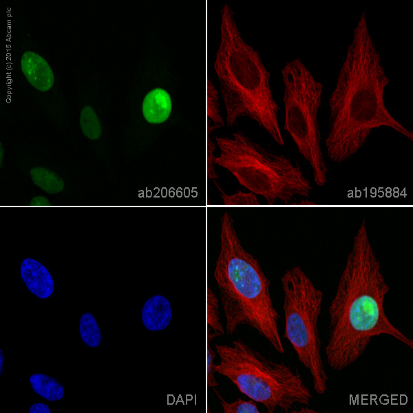 Immunocytochemistry/ Immunofluorescence - Alexa Fluor® 555 Anti-Topoisomerase II alpha + Topoisomerase II beta/TOP2B antibody [EPR5377] (AB206605)