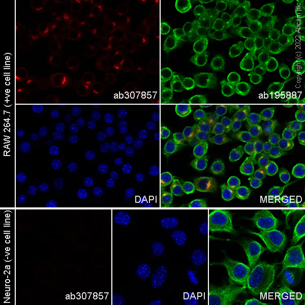 Immunocytochemistry/ Immunofluorescence - Alexa Fluor® 555 Anti-TREM2 antibody [EPR23177-106] (AB307857)