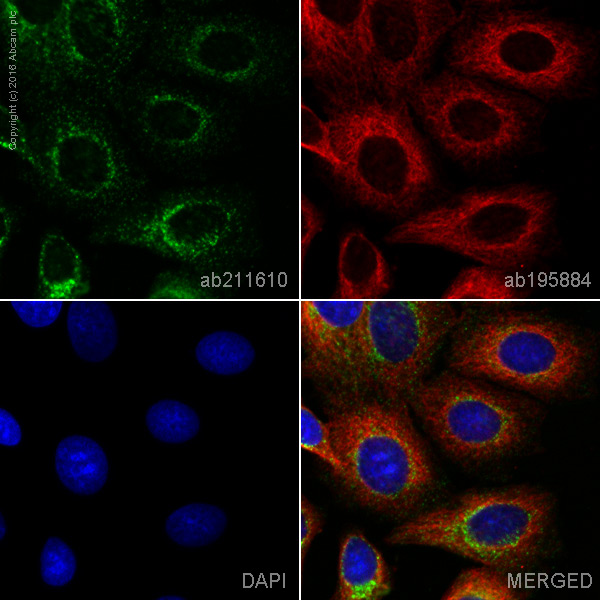 Alexa Fluor® 555 Anti-TRK fused gene antibody [EPR8766] (ab211610) | Abcam