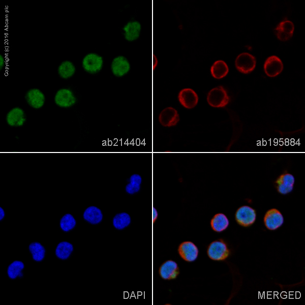 Immunocytochemistry/ Immunofluorescence - Alexa Fluor® 555 Anti-TSG101 antibody [EPR7130(B)] (AB214404)