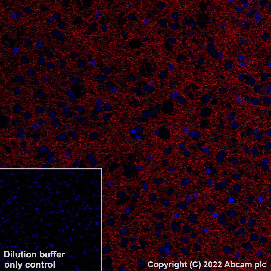 Immunohistochemistry (Formalin/PFA-fixed paraffin-embedded sections) - Alexa Fluor® 555 Anti-Tyrosine Hydroxylase antibody [EP1532Y] - Neuronal Marker (AB305365), expandable thumbnail