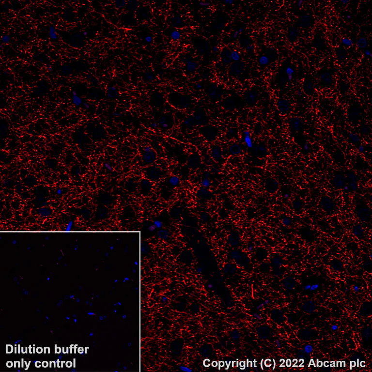 Immunohistochemistry (Formalin/PFA-fixed paraffin-embedded sections) - Alexa Fluor® 555 Anti-Tyrosine Hydroxylase antibody [EP1532Y] - Neuronal Marker (AB305365)