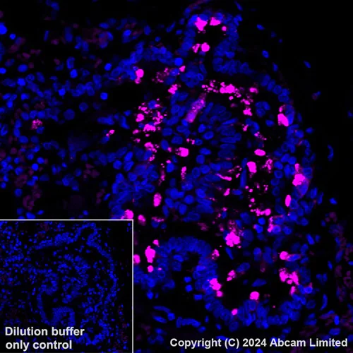 Immunohistochemistry (Formalin/PFA-fixed paraffin-embedded sections) - Alexa Fluor® 555 Anti-Uteroglobin antibody [EPR27144-86] (AB322394)