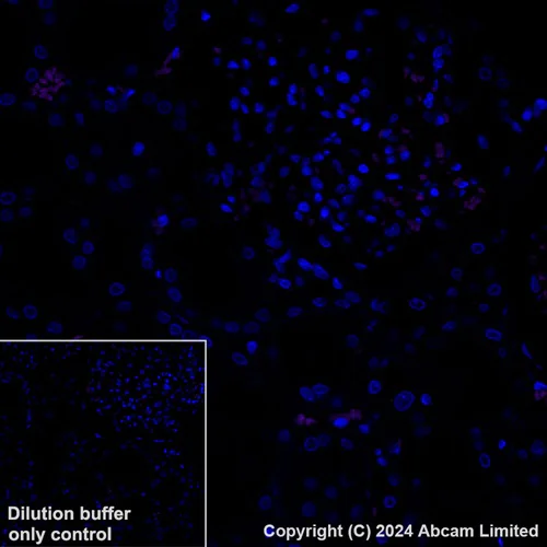 Immunohistochemistry (Formalin/PFA-fixed paraffin-embedded sections) - Alexa Fluor® 555 Anti-Uteroglobin antibody [EPR27144-86] (AB322394)