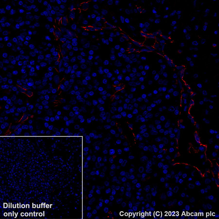 Immunohistochemistry (Formalin/PFA-fixed paraffin-embedded sections) - Alexa Fluor® 555 Anti-VE Cadherin antibody [EPR27436-55] (AB317067)