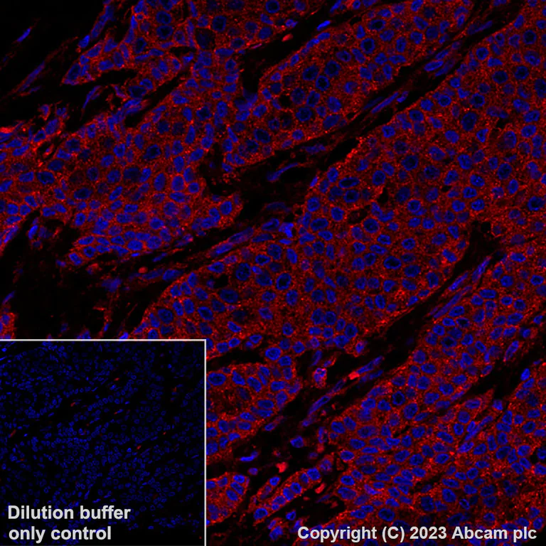 Immunohistochemistry (Formalin/PFA-fixed paraffin-embedded sections) - Alexa Fluor® 555 Anti-VEGF Receptor 1 antibody [Y103] (AB309079)