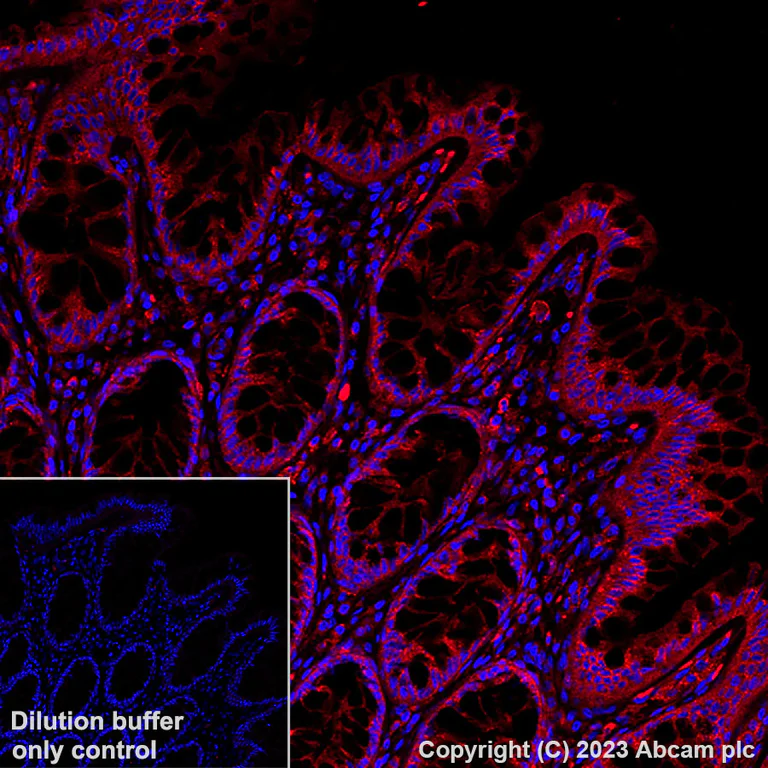 Immunohistochemistry (Formalin/PFA-fixed paraffin-embedded sections) - Alexa Fluor® 555 Anti-VEGF Receptor 1 antibody [Y103] (AB309079)