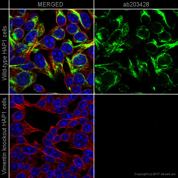 Alexa Fluor® 555 conjugated Anti-Vimentin antibody [EPR3776