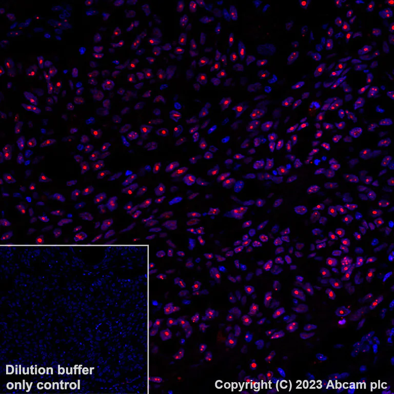 Immunohistochemistry (Formalin/PFA-fixed paraffin-embedded sections) - Alexa Fluor® 555 Anti-Wilms Tumor Protein antibody [CAN-R9(IHC)-56-2] (AB314587)